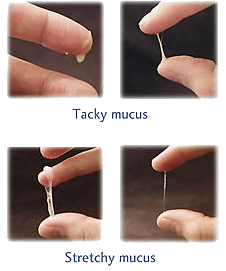 Pictures of Cervical Mucus